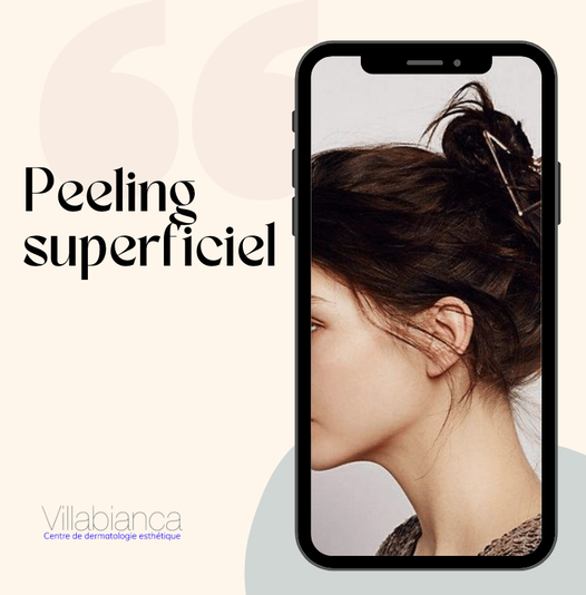 PEELING SUPERFICIEL