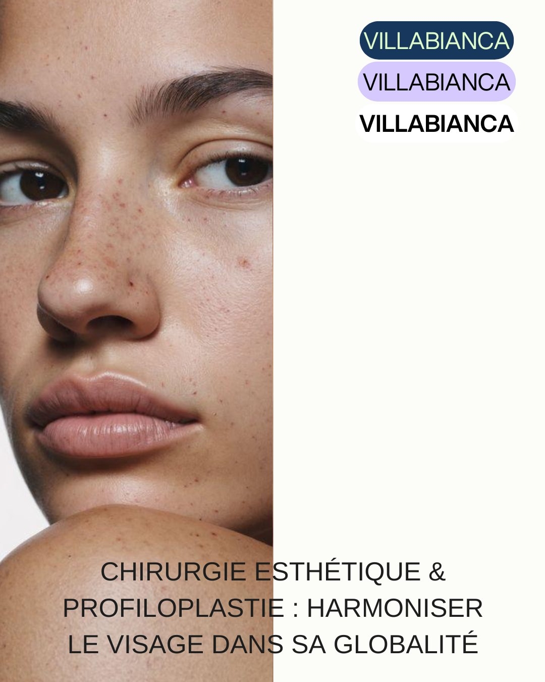 Chirurgie esth&eacute;tique & profiloplastie : harmoniser le visage dans sa globalit&eacute;