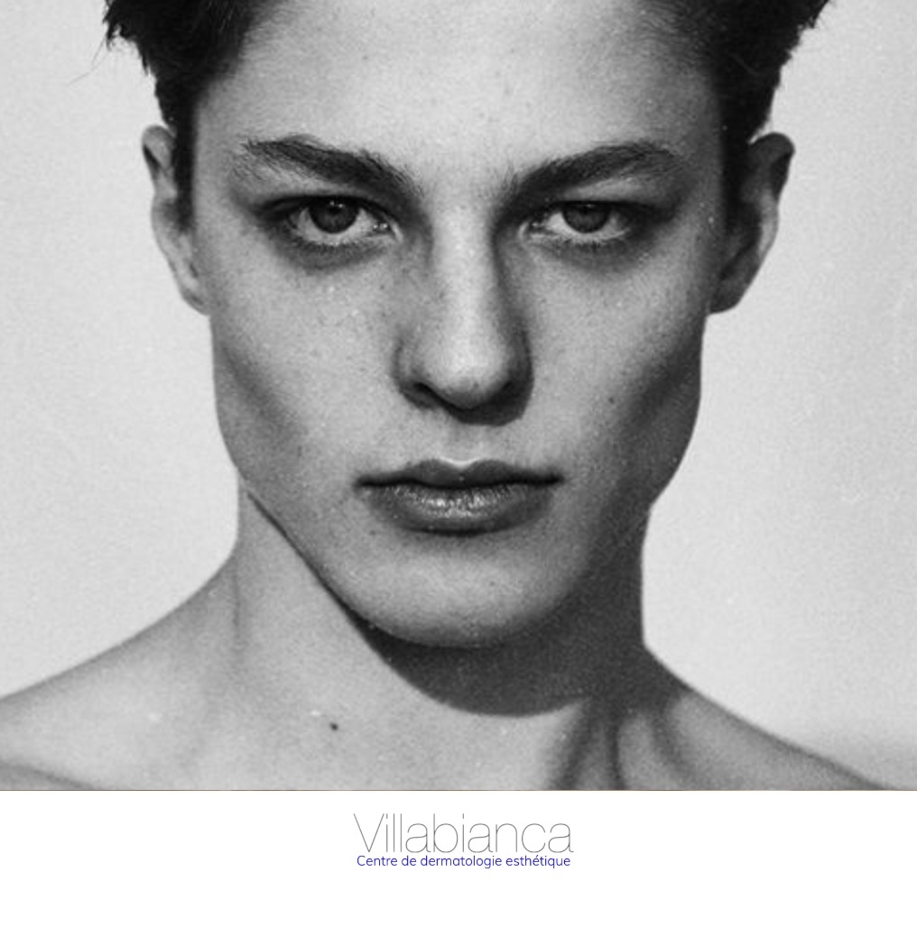 Comment masculiniser un menton ?