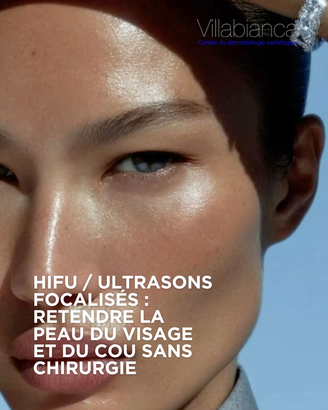 HIFU / Ultrasons focalis&eacute;s : retendre la peau du visage et du cou sans chirurgie