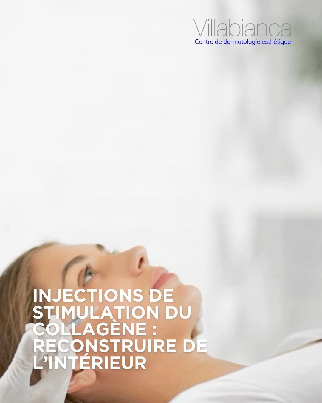 Injections de stimulation du collag&egrave;ne : reconstruire de l&rsquo;int&eacute;rieur