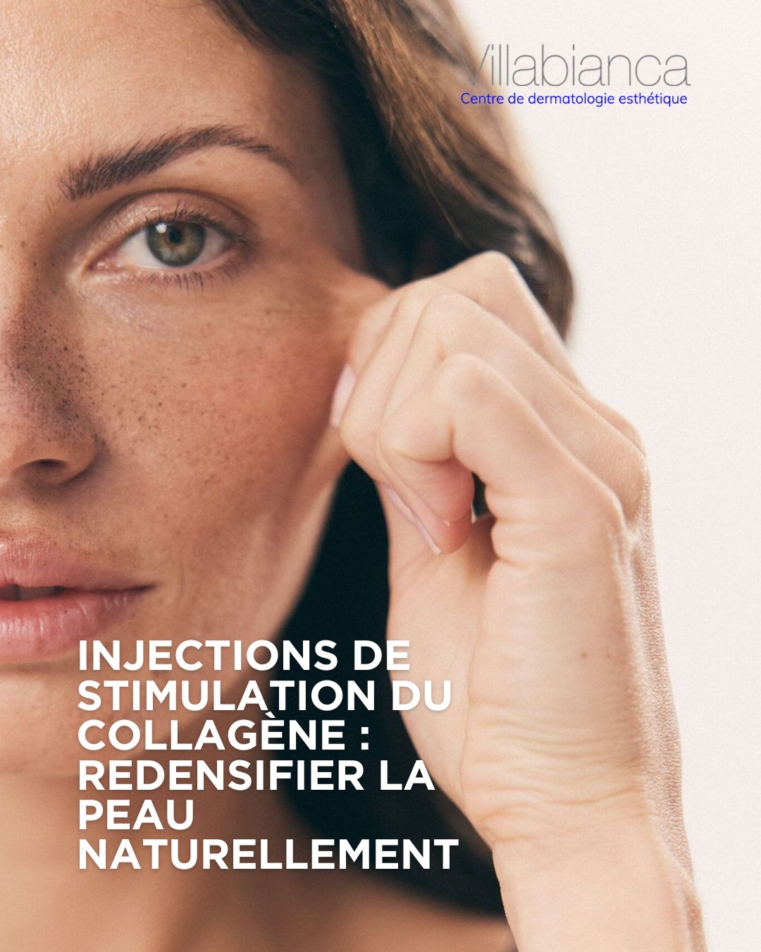Injections de stimulation du collag&egrave;ne : redensifier la peau naturellement