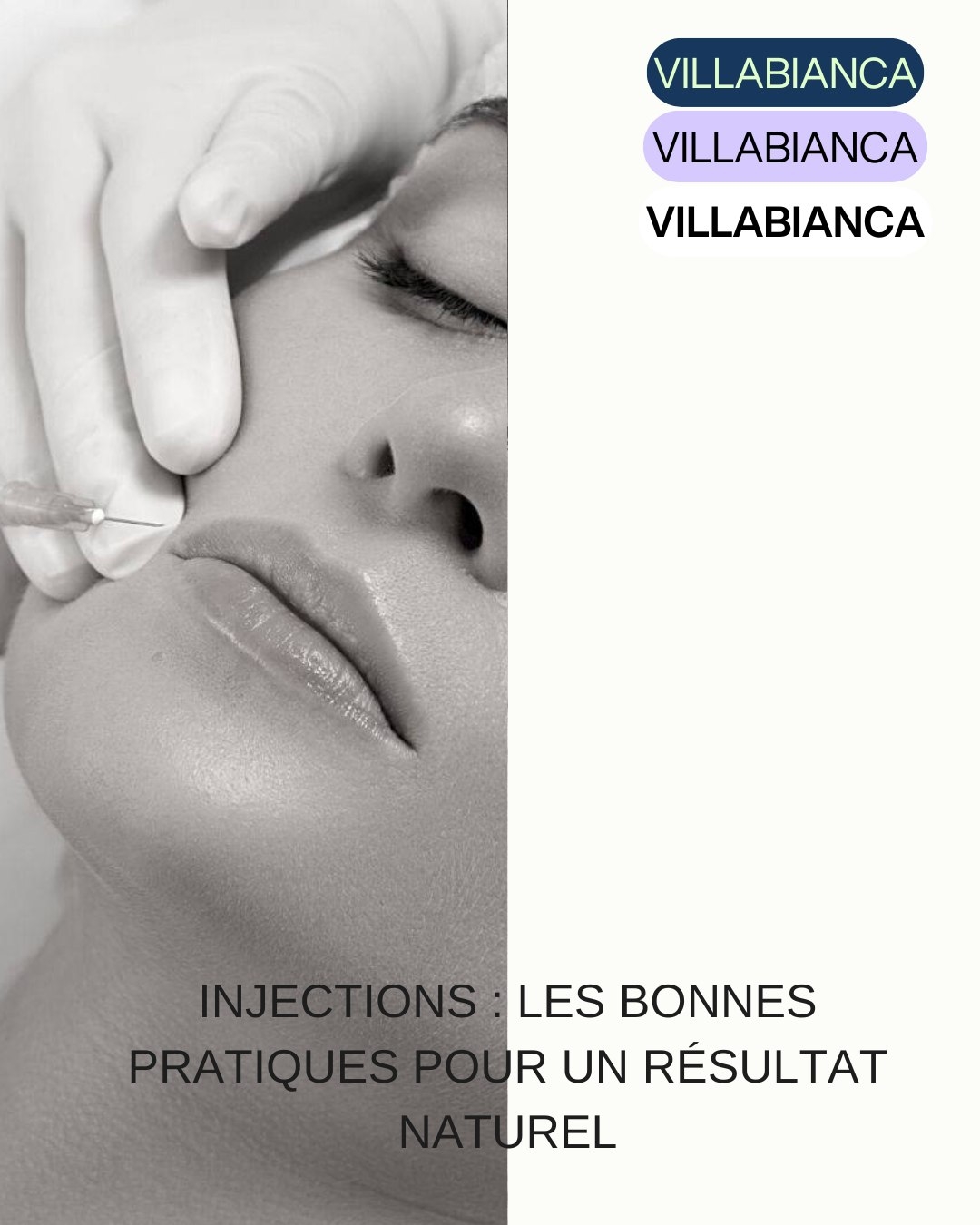 Injections : les bonnes pratiques pour un résultat naturel