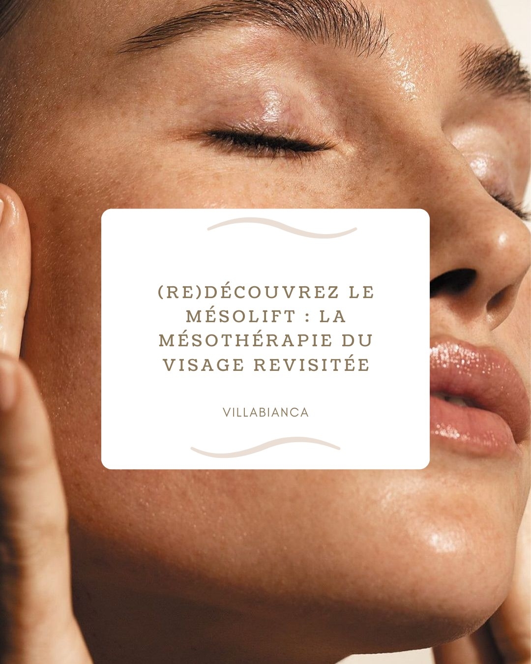 (Re)découvrez le mésolift : la mésothérapie du visage revisitée