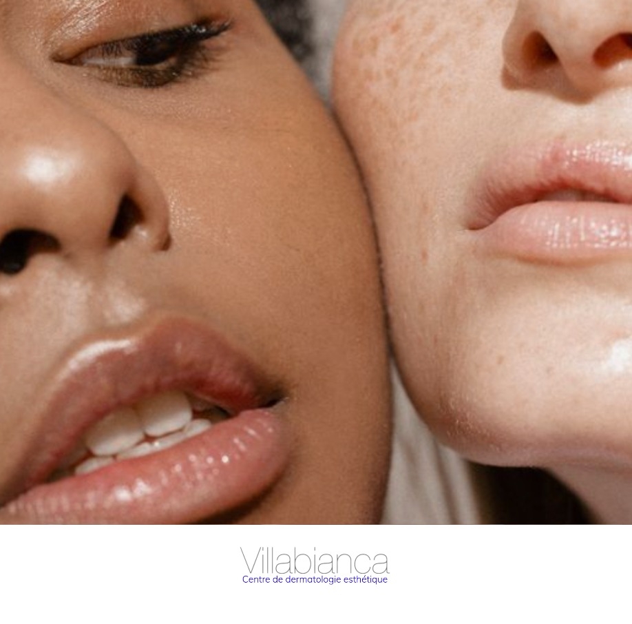 Un ovale de visage magnifié ?